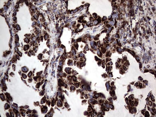 PIK3CD / PI3K Delta Antibody (aa286-610, clone OTI1D11)