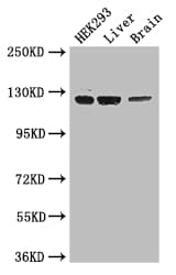 GUCY2C / Guanylyl Cyclase C Antibody