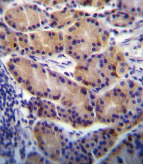 Polyclonal Rabbit anti-Human CYP2S1 Antibody (aa399-428, IHC, IF, WB)