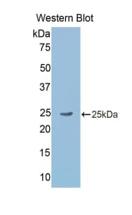 GKN2 / Gastrokine 2 Antibody (aa21-184, PE)
