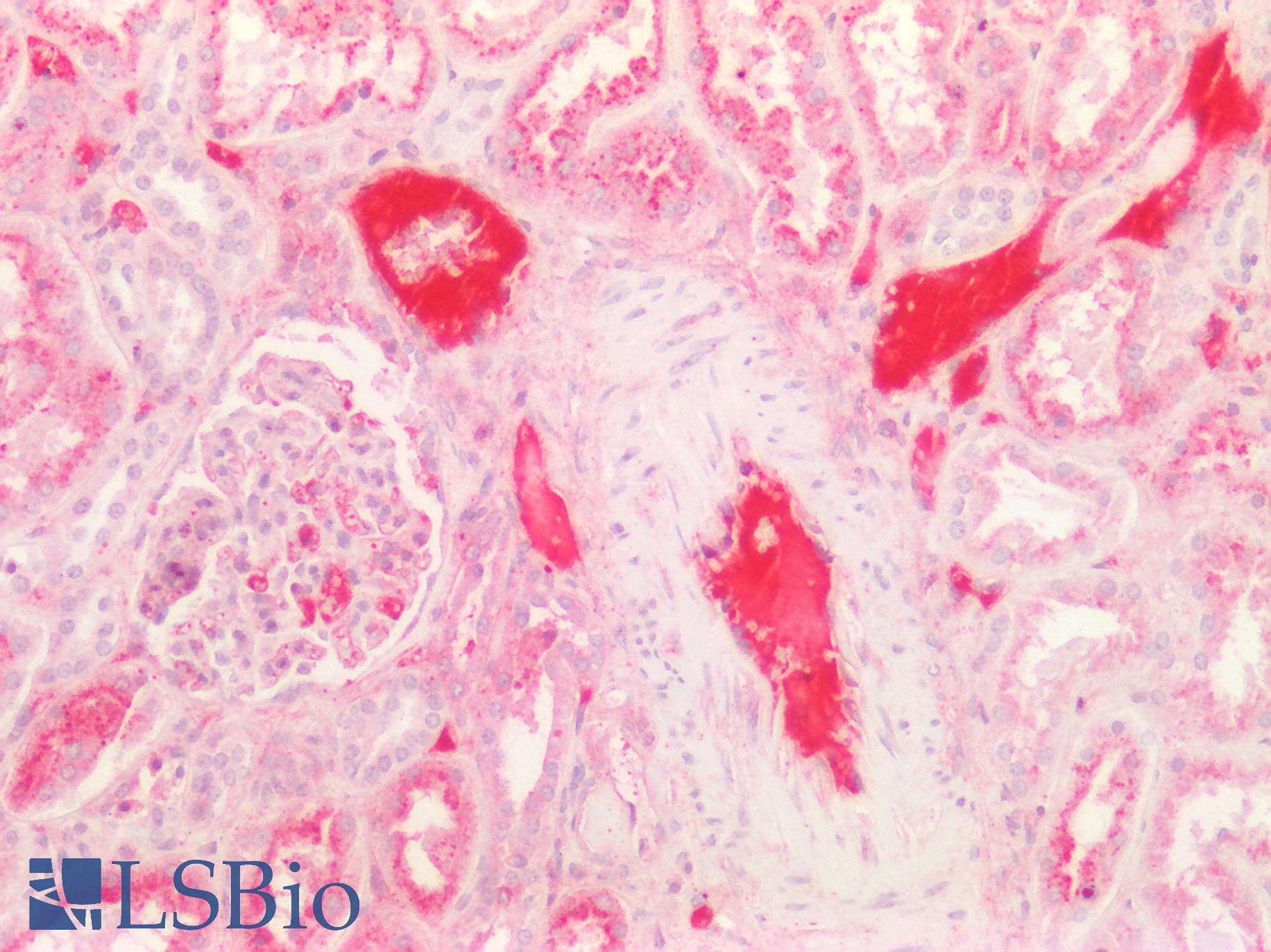 PathPlus™ KNG1 / Kininogen / Bradykinin Antibody (aa251-300)