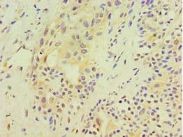 SRM / Spermidine Synthase Antibody (aa1-302)