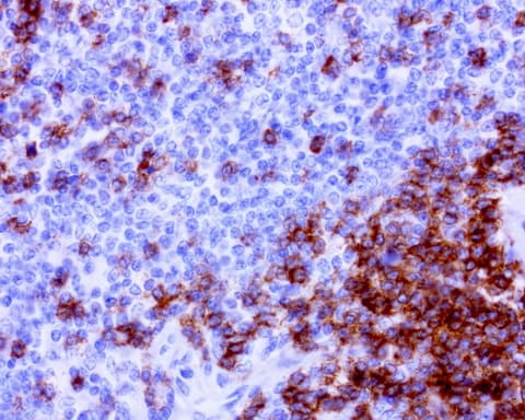 CD2 Antibody (clone UMAB86)