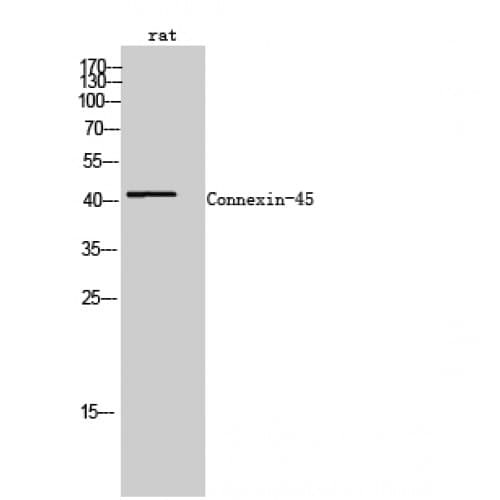 Polyclonal Rabbit anti-Human GJC1 / CX45 / Connexin 45 Antibody (346-396 aa, C-terminal, IHC, WB)
