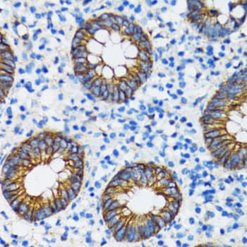 CTNNA1 / Catenin Alpha-1 Antibody