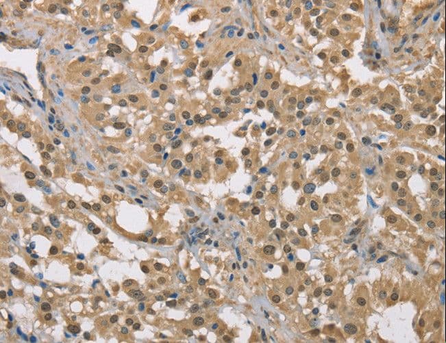 DACH2 Antibody