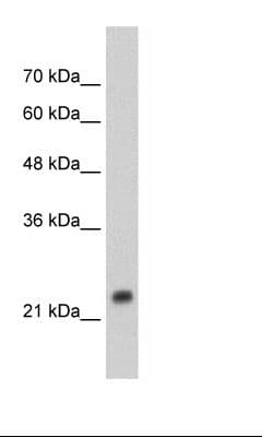 Polyclonal Rabbit anti-Human HSPB1 / HSP27 Antibody (C-Terminus, IHC, WB)