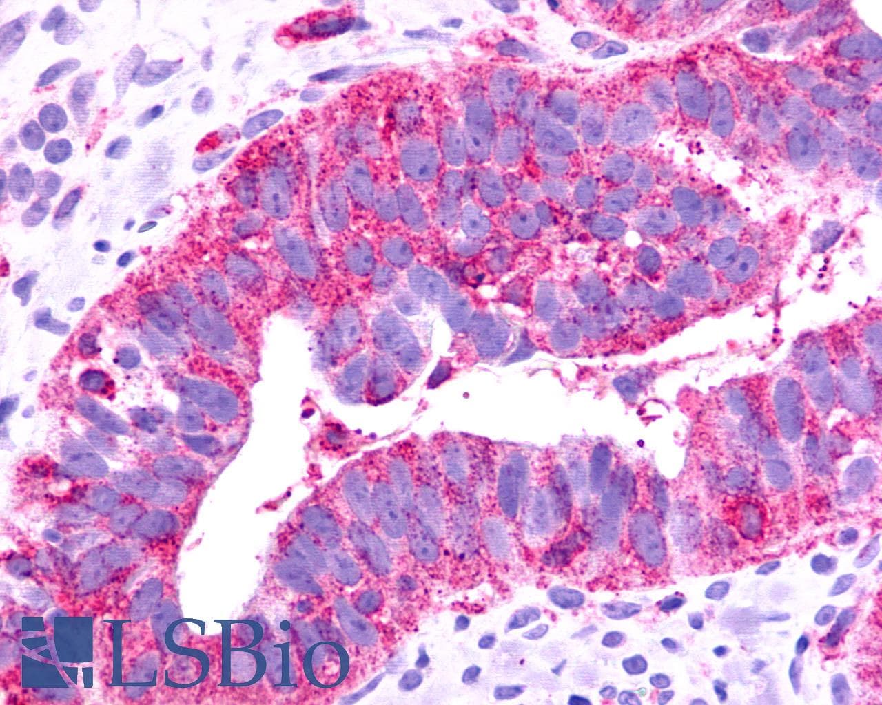PathPlus™ Polyclonal Rabbit anti-Human FKSG80 / GPR81 Antibody (C-Terminus, IHC)