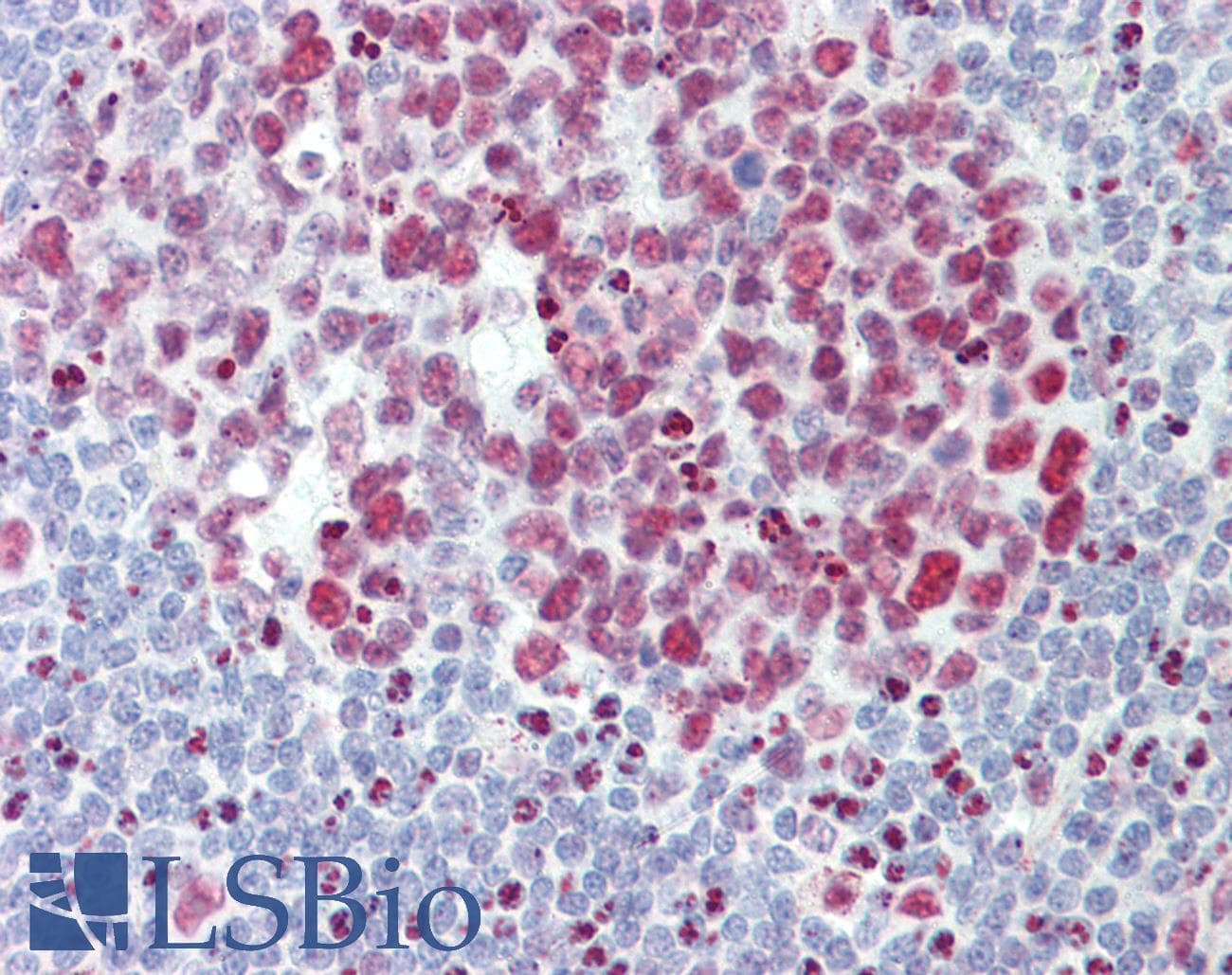 IHC-plus™ HNRNPAB Antibody (aa1-30)