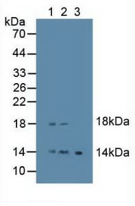 EREG / Epiregulin Antibody (aa30-169, PE)