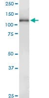 GUCY2D Antibody (clone 4E12)