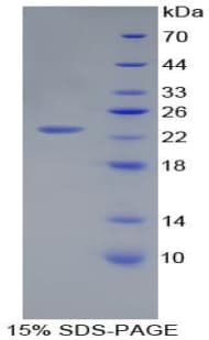 Rat PGLYRP1 / PGRP Protein (Recombinant His-T7)