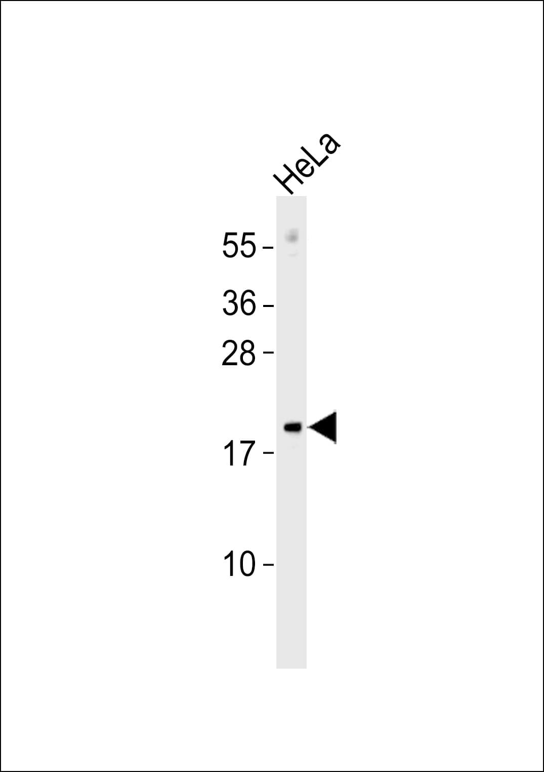 MRPL17 Antibody