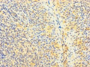 SNX22 Antibody
