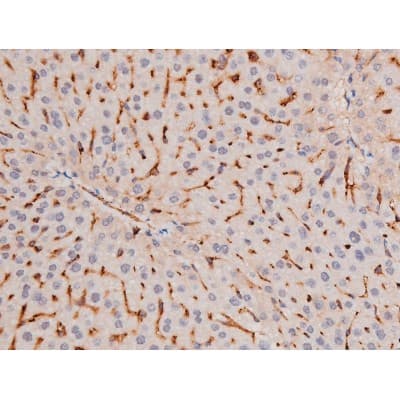 ADD1 / Adducin Alpha Antibody (phospho-Ser726)