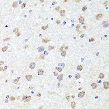 Polyclonal Rabbit anti-Human CHD1 Antibody (IHC, WB)