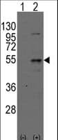 DTNBP1 / Dysbindin Antibody (aa8-38)
