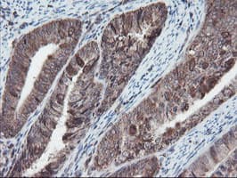 Monoclonal Mouse anti-Human SKIL / SNO / SnoN Antibody (clone OTI3E2, IHC, WB)