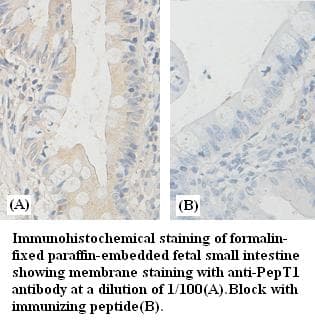 Polyclonal Rabbit anti-Human SLC15A1 / PEPT1 Antibody (IHC, WB)