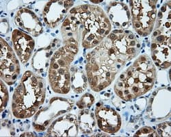 TPMT Antibody (clone OTI5B4)