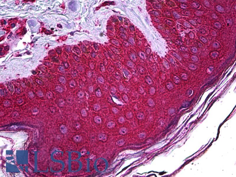 IHC-plus™ ABHD5 Antibody (clone 1F3)