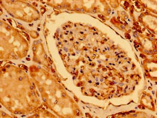 Polyclonal Rabbit anti-Human CHDH / CHD Antibody (IHC)