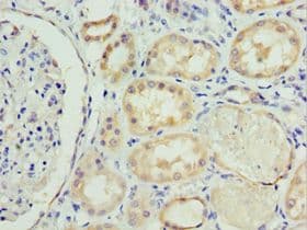 Polyclonal Rabbit anti-Human SOST / Sclerostin Antibody (aa24-213, IHC, WB)