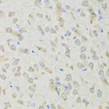 Polyclonal Rabbit anti-Human CLC-7 / CLCN7 Antibody (IHC, WB)