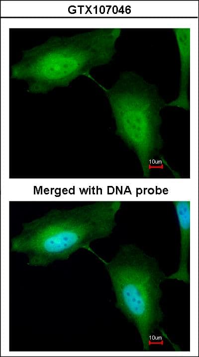 IHC-plus™ Polyclonal Rabbit anti-Human RNF114 / ZNF313 Antibody (aa1-228, IHC, WB)