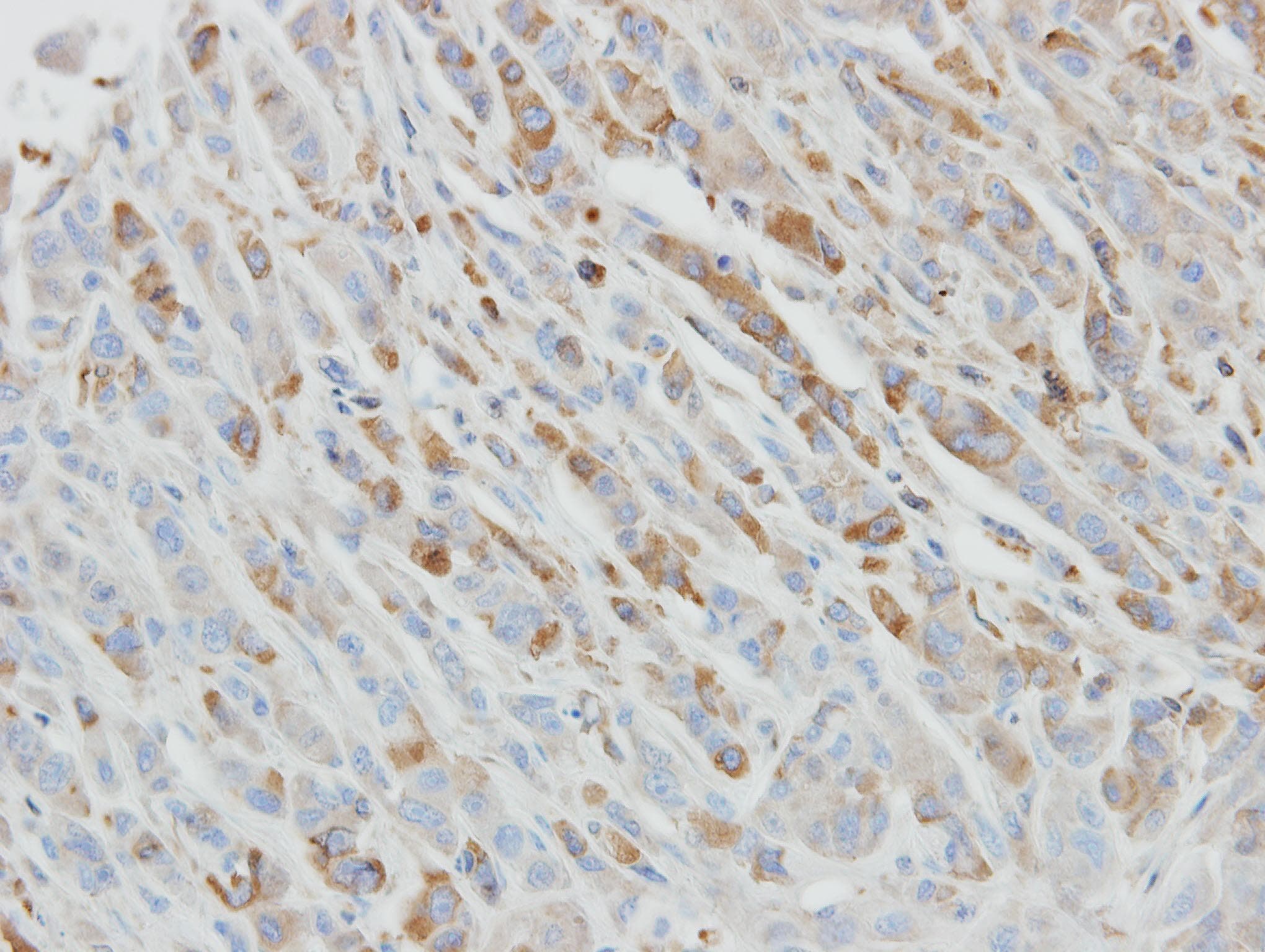 IL1RN Antibody (aa1-177)