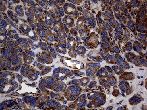 Monoclonal Mouse anti-Human DIRAS2 Antibody (clone OTI8A5, aa1-196, IHC, WB)