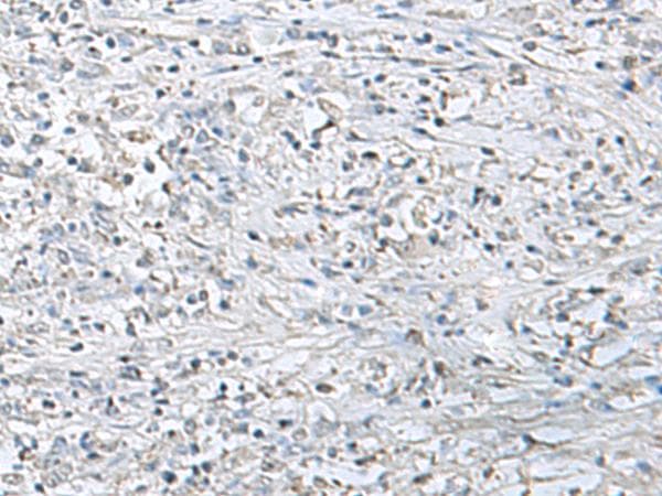 EPM2A / Laforin Antibody