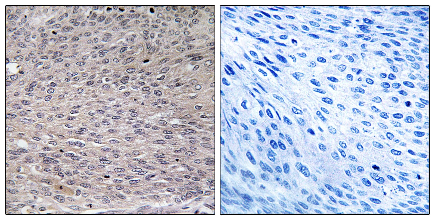 Polyclonal Rabbit anti-Human ACO1 / Aconitase Antibody (phospho-Ser711, IHC, WB)