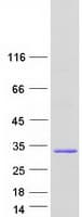 Human MOB1A Protein (Recombinant Myc-DDK (Flag))