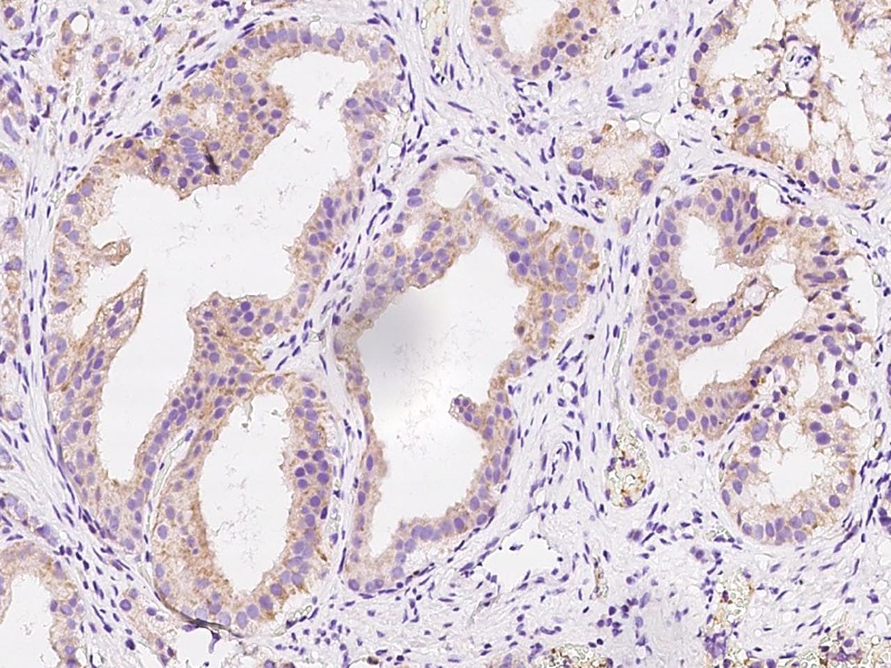 HLCS / HCS Antibody