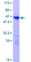 Human UBR7 / C14orf130 Protein (Recombinant GST)