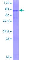 Human ENTPD6 Protein (Recombinant GST)