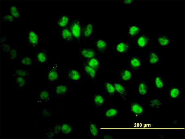IHC-plus™ Monoclonal Mouse anti-Human STAG2 Antibody (clone 3C6, IHC, IF, WB)