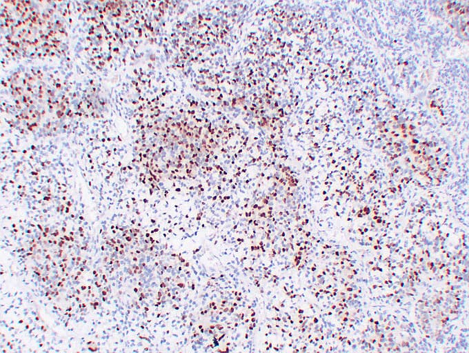 MYOG / Myogenin Antibody (clone ABT-MYOG)