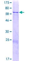 Human ANKDD1A Protein (Recombinant GST)