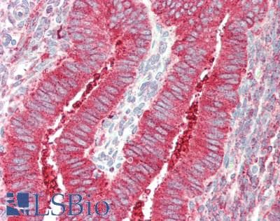 IHC-plus™ IRS2 / IRS-2 Antibody (aa1288-1338)