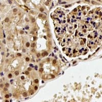 PDCD6 / ALG-2 Antibody