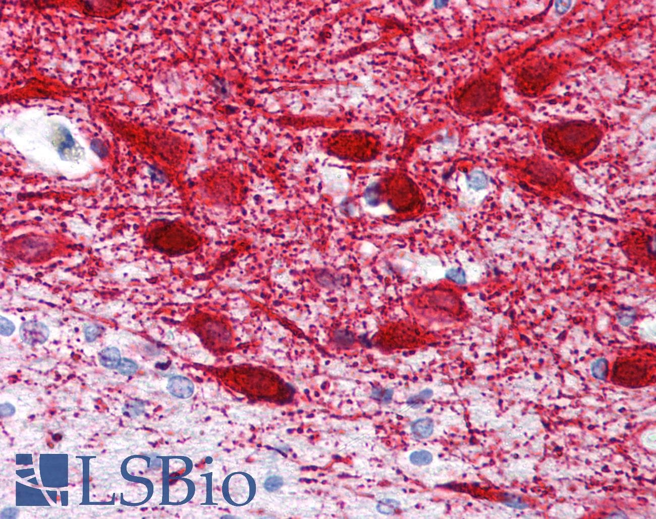 IHC-plus™ MAP2 Antibody (clone MT-08)