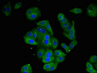 AMD / AMD1 Antibody