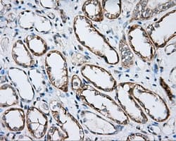 BTK Antibody (clone OTI3A2)
