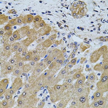 FOXO3 / FOXO3A Antibody