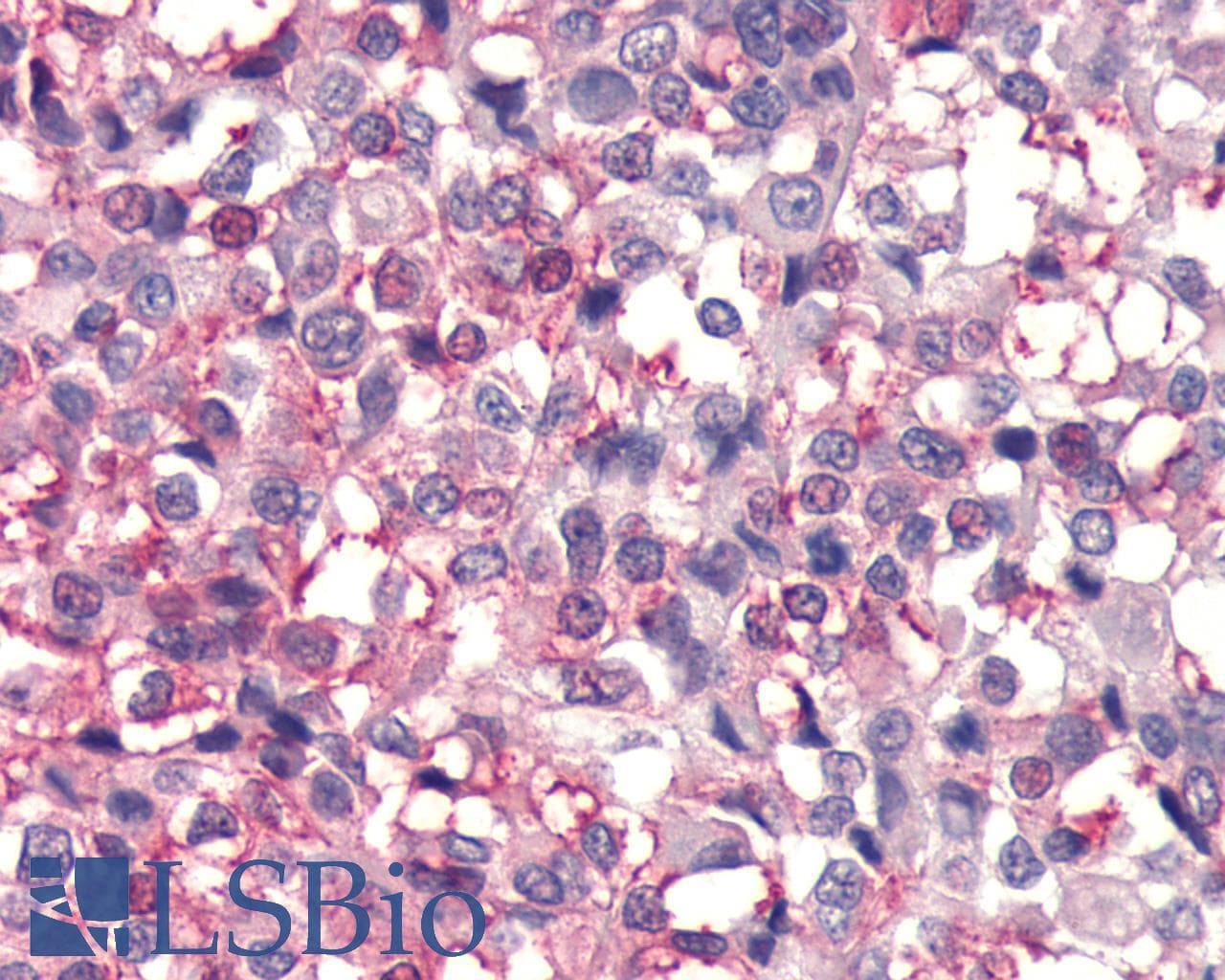 PathPlus™ FZD4 / Frizzled 4 Antibody (C-Terminus)