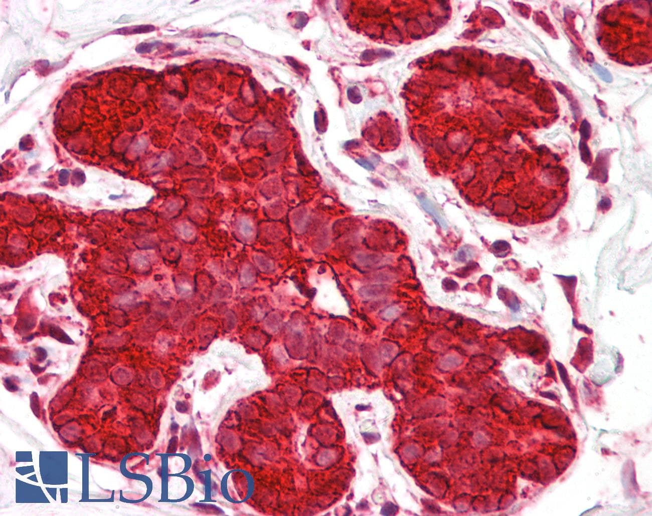 IHC-plus™ HSP90AA1 / Hsp90 Alpha A1 Antibody (aa683-732)