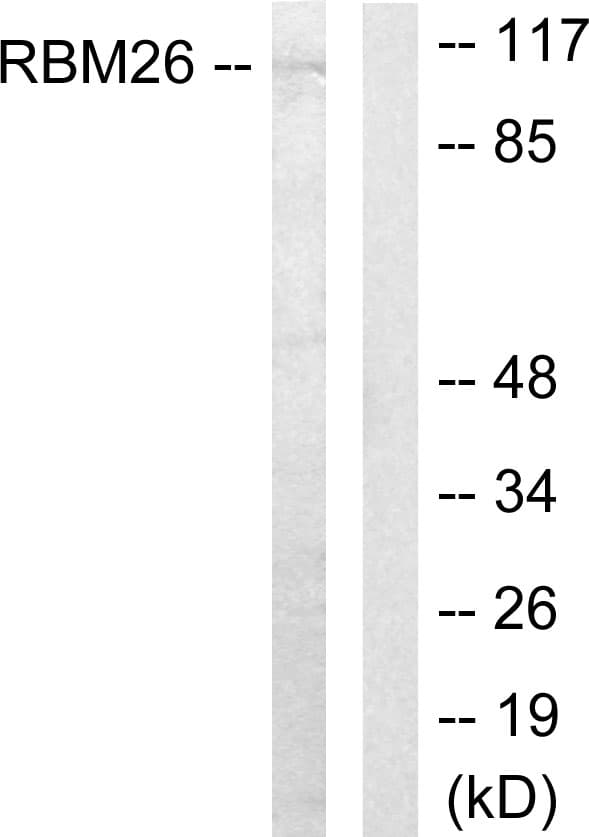 Polyclonal Rabbit anti-Human RBM26 / SE70 Antibody (aa711-760, WB)