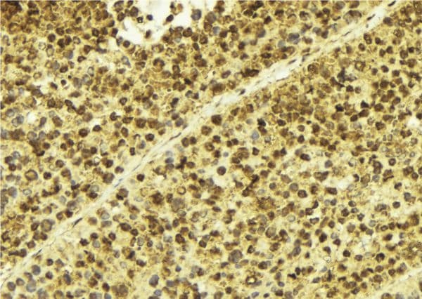 SP100 Antibody